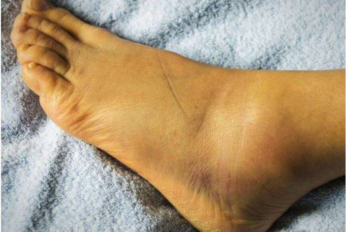 هشت بیماری جدی که از پاهایتان تشخیص داده می شوند