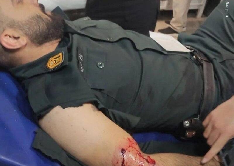 گلوله‌ای که نشان ایثار بر بازوی این پلیس شد!+عکس