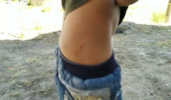 فیلم/ حمله سگ‌ولگرد به یک کودک در حواشی بجنورد