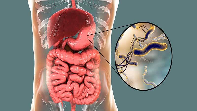 راه‌های تشخیص و انتقال میکروب معده