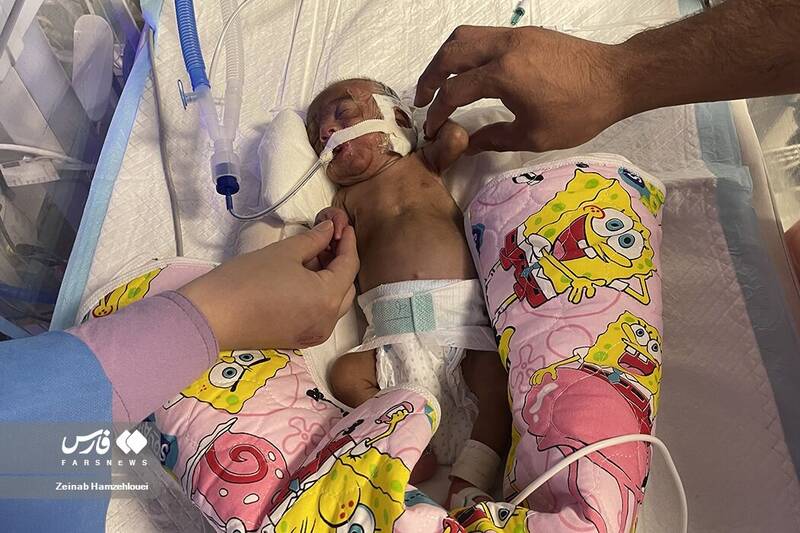 اعلام علت فوت ۶ نوزاد در بیمارستان هاجر +جزئیات