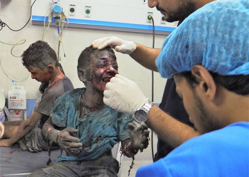 ۳۰ تا ۴۰ درصد مجروحان بمباران غزه کودکان هستند